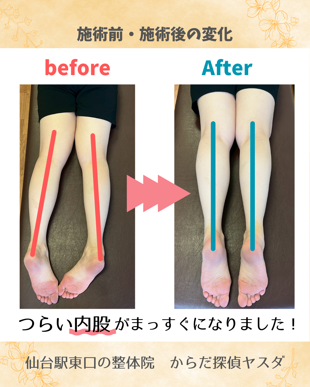【ヘッド＋骨格調整の変化】内股がまっすぐに！