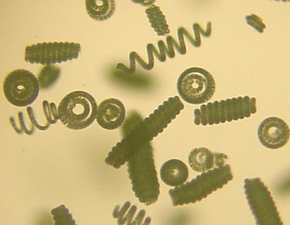 Spiruline vu au microscope avec un agrandissement de 100