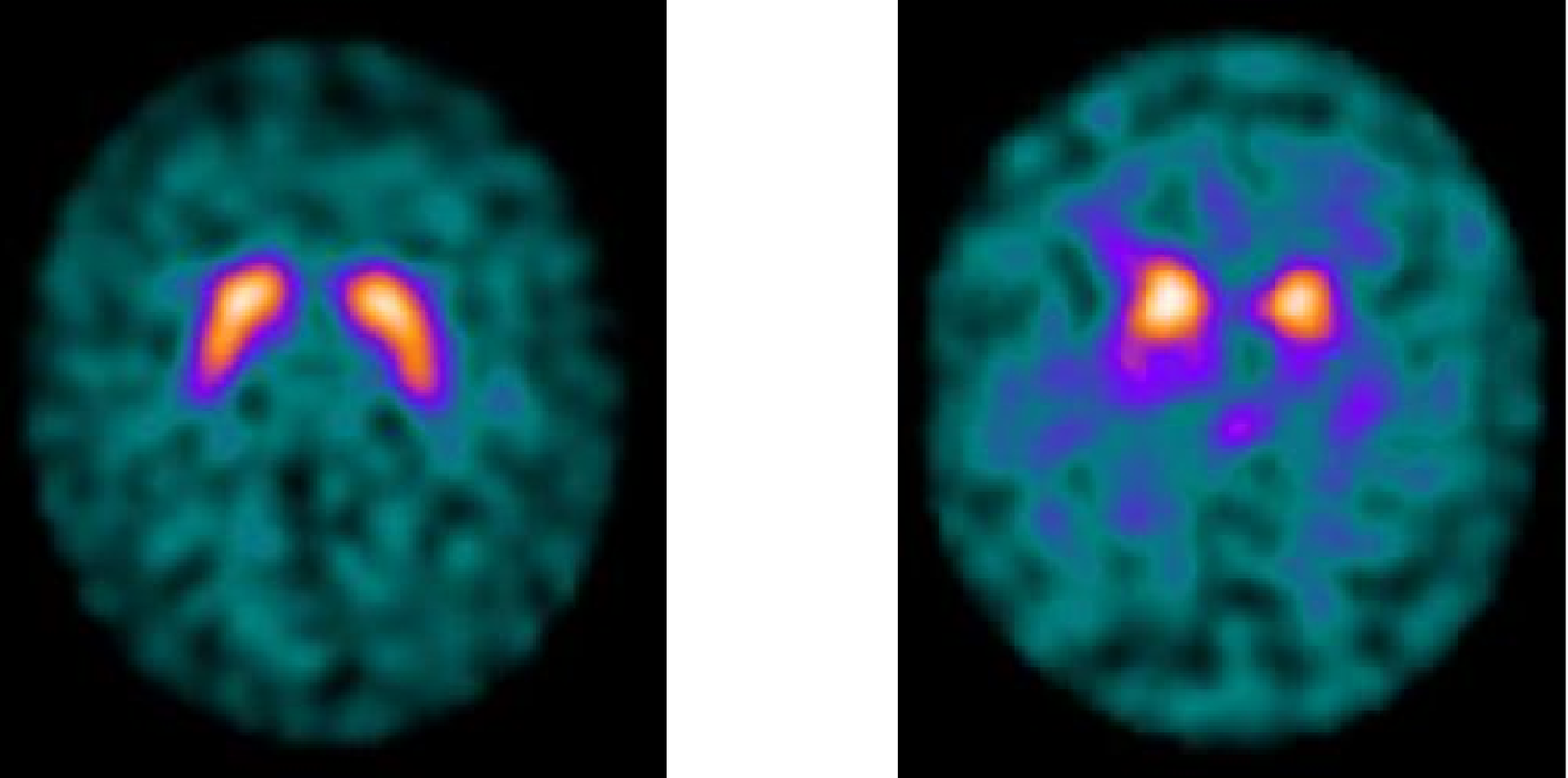 DaTSCAN Radiologische Praxis Schwelm
