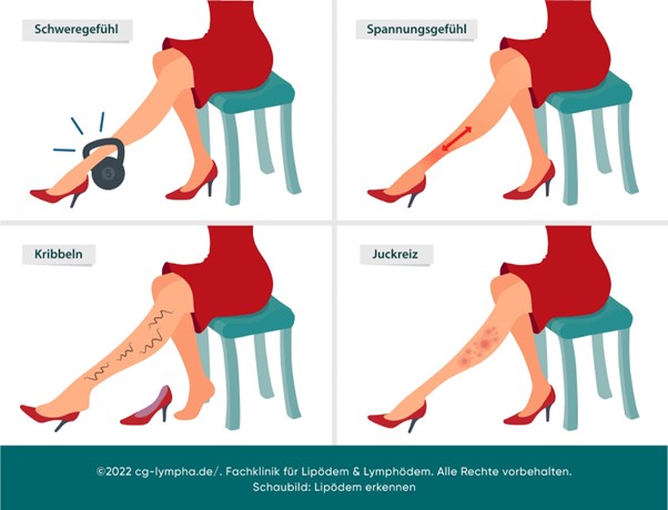 Lipödem MelinaDiego