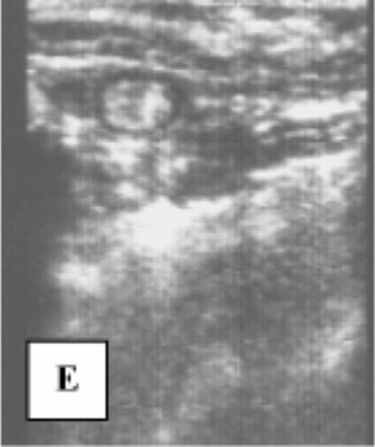 hund sonographie ultraschall / dog ultrasonography ultrasound