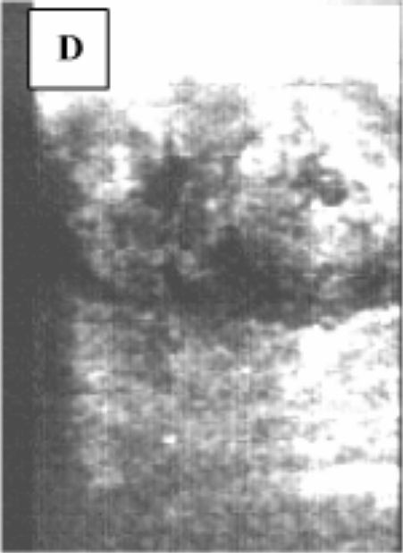 hund sonographie ultraschall / dog ultrasonography ultrasound