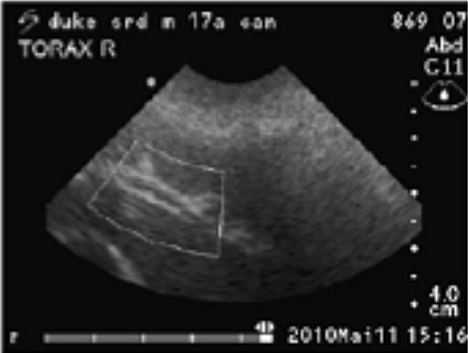 Generally Sonography Atlas of Dogs Osteosarkom Hund / Osteosarcoma