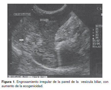 The Ultrasonography As An Assistance To Diagnostic Of