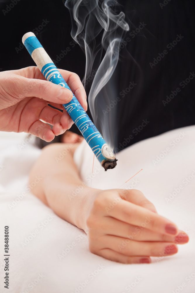 Moxibustion: Wärmebehandlung zur Stärkung der Lebensenergie.