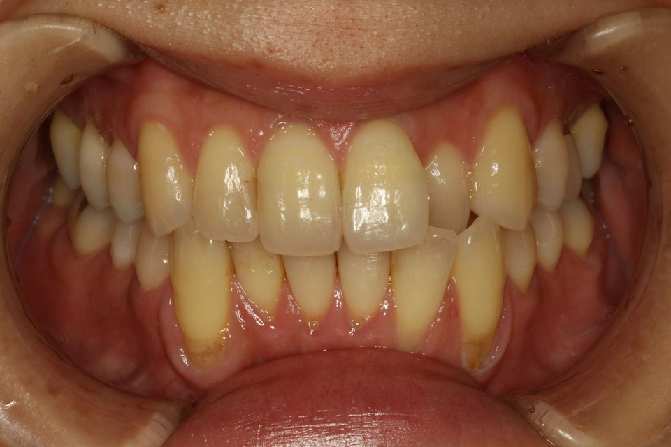 歯茎の悩み、解消へ導く。歯科の新治療法に自信を。歯茎を回復させる歯科治療