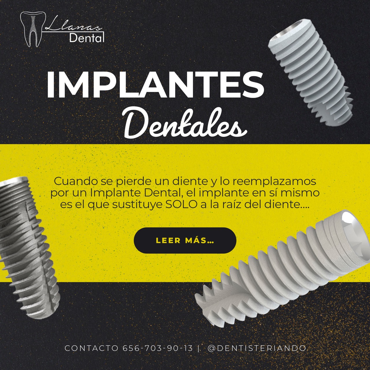 implantes Dental