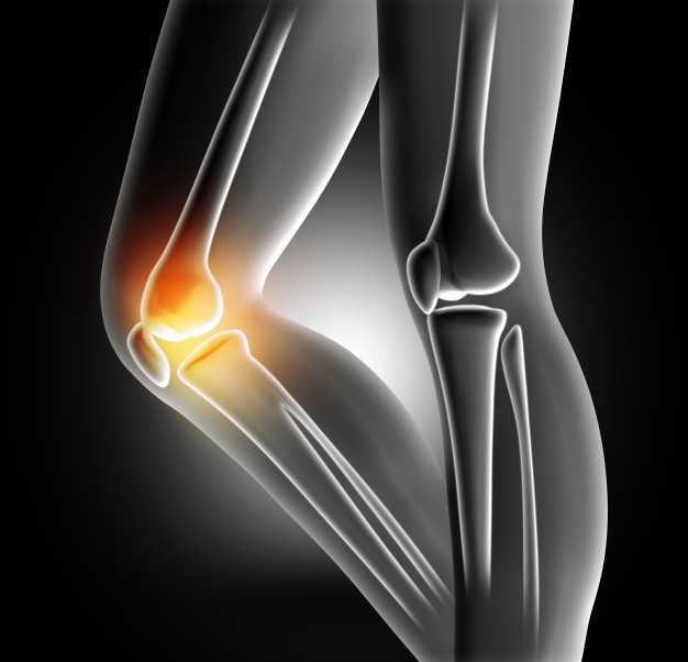 【姫路】「変形性膝関節症」特別治療の内容【膝の変形】
