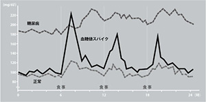 血糖値スパイク