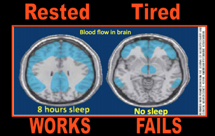 Image result for brain without sleep