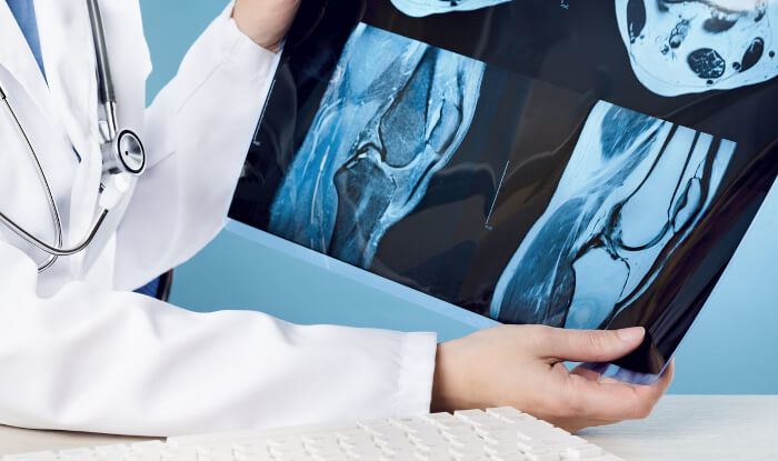 Ärztin zeigt Röntgenbild eines Gelenks