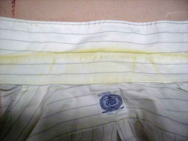 【Before】黄ばんだエリも・・・