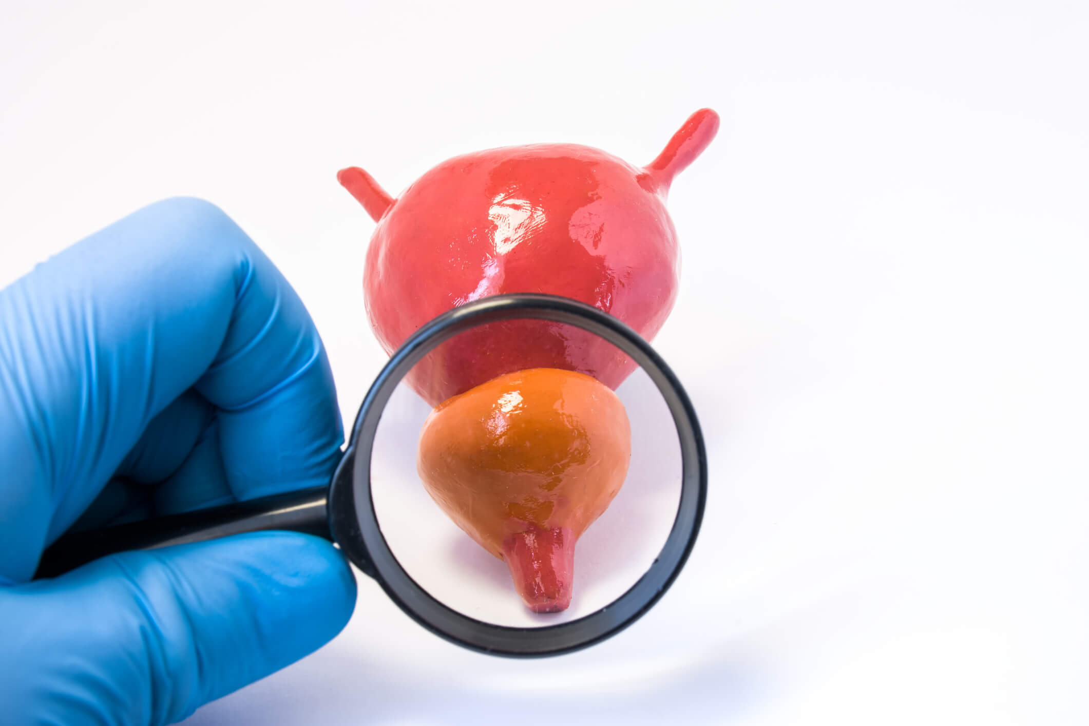 Was tun, wenn die Prostata wächst? Symptome Prostatazentrum Hirslanden