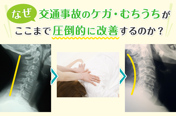 自賠責保険