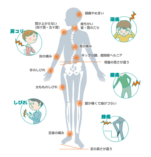 自律神経失調症