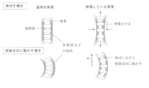 背骨の伸張（エロンゲーション）おイメージ