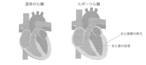 スポーツ心臓