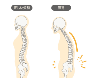 生理的湾曲の図（S字カーブのイラスト）