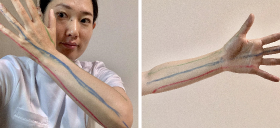 腕の経絡マッサージ講座 画像