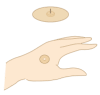 円皮鍼のイラスト