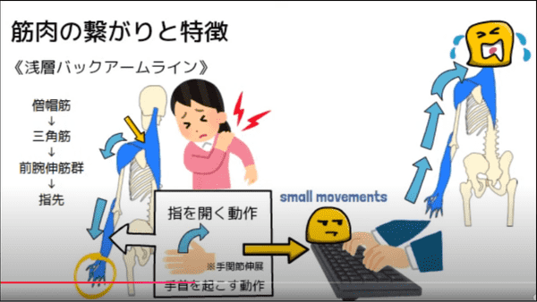 バックアームライン