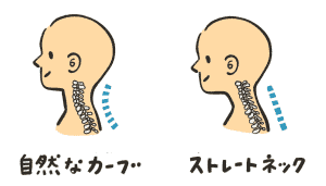 ストレートネックの画像（ヘッドライフ）