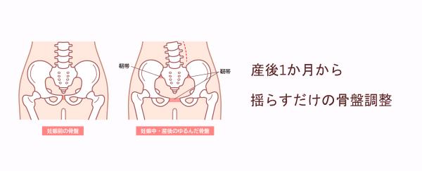 産後1か月から揺らすだけの骨盤調整