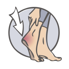 Achillessehne und Ferse: Achillodynie (Schmerzsyndrom der Achillessehne), Plantare Fußmuskulatur, Fasciitis Plantaris (Fersensporn)