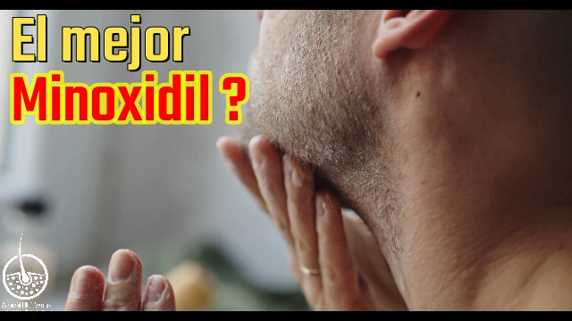 l mejor minoxidil para barba