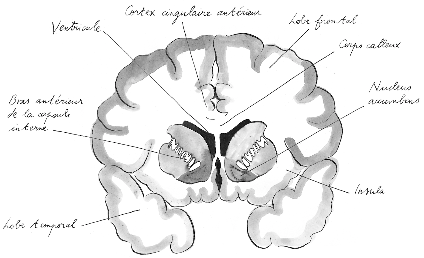 Coupe frontale du cerveau