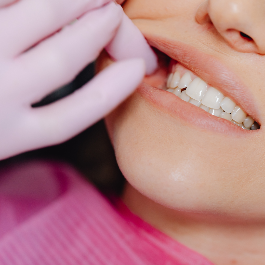 ¿Es normal que los dientes se muevan después del tratamiento de ortodoncia?