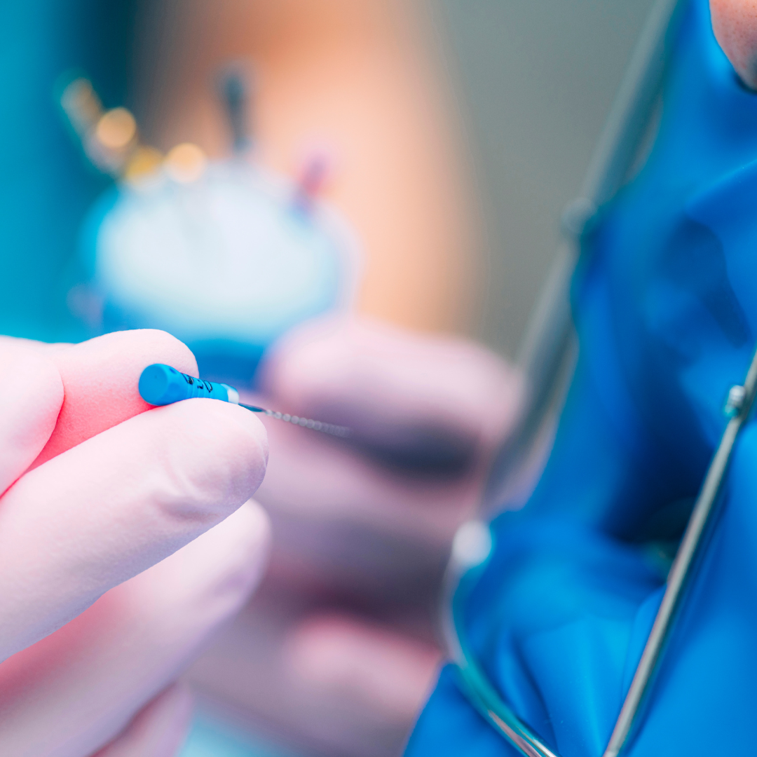 Precio de una endodoncia en España