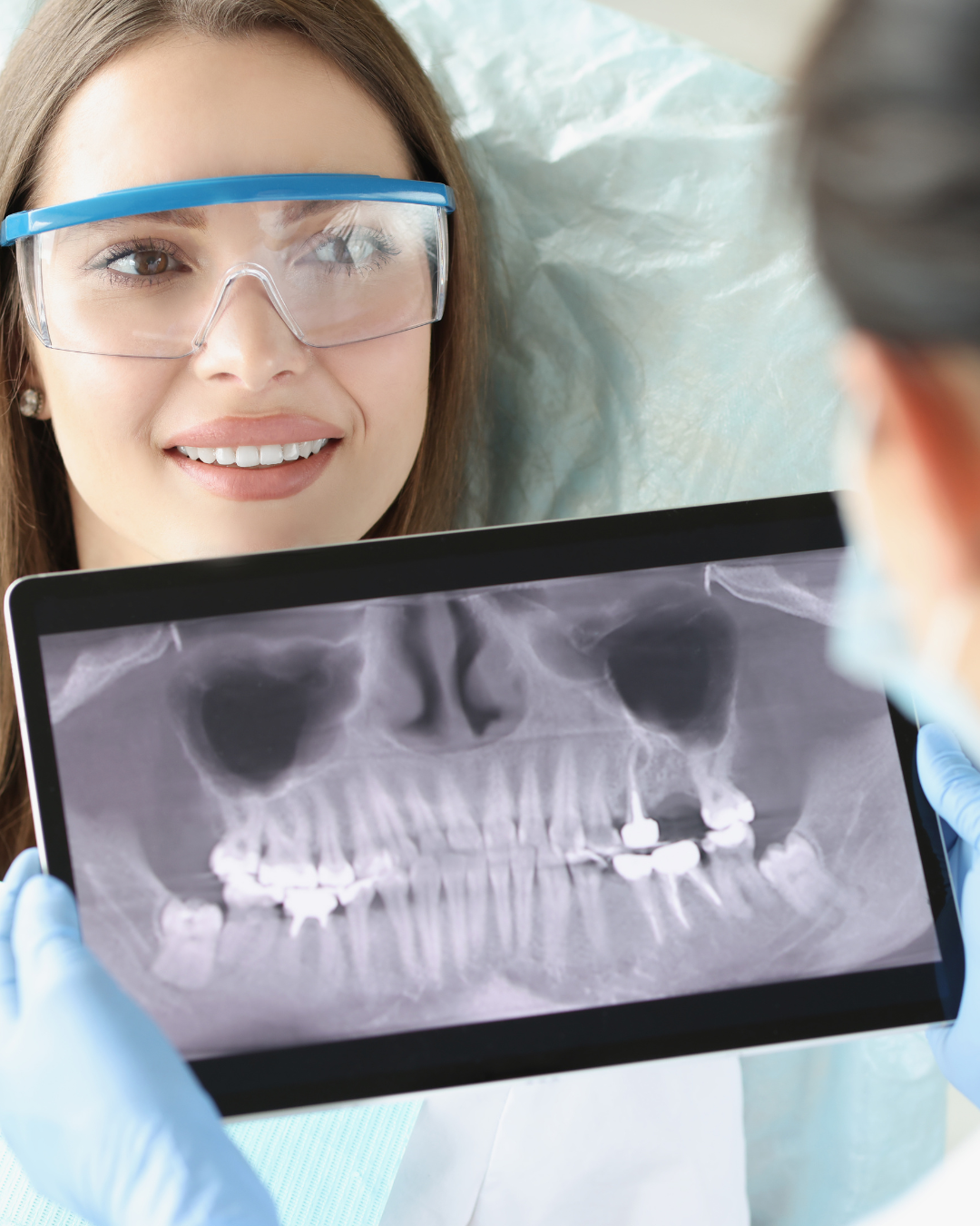 La importancia del control periodontal después de un tratamiento: por qué no debes saltarte tus revisiones