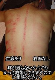 疲労回復かっさエステ ティータイム 神奈川県海老名市のフェイシャルエステサロン 疲労回復かっさエステ ティータイム 神奈川県海老名市のフェイシャルエステサロン