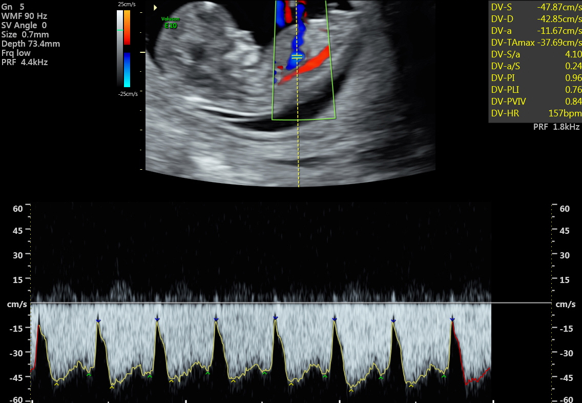 Schwangere für Ultraschallfortbildung gesucht!