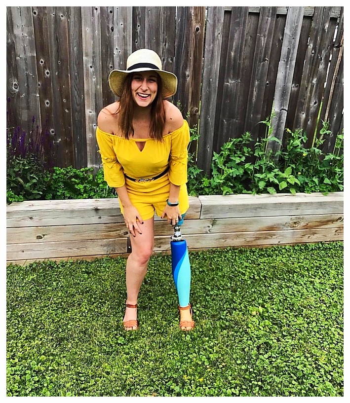 Being a confident amputee: Having survived cancer, Lisa is now mentoring other cancer patients and new amputees (picture courtesy of Lisa Ludwig)