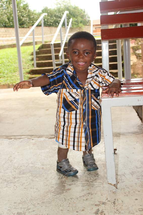 Miracle is a happy little boy living a normal life after both his legs were amputated and he received his first set of prosthetic legs (picture courtesy of CoRSU).