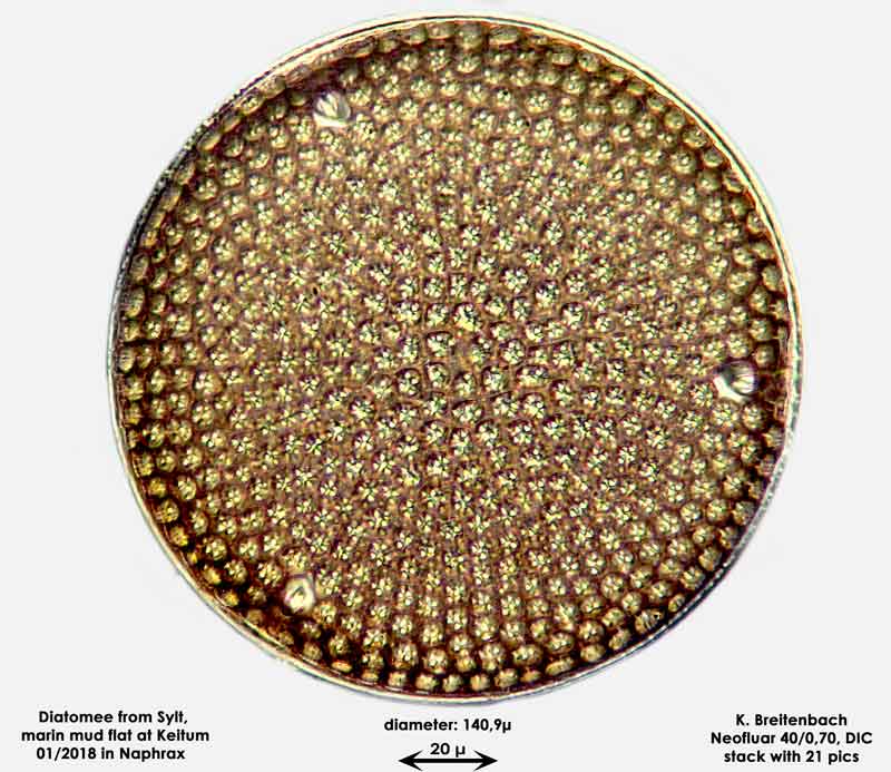 Bild 10 Diatomee aus Sylt/Keitum Watt, Art: Aulacodiscus argus (Ehrenberg) Schmidt 1886