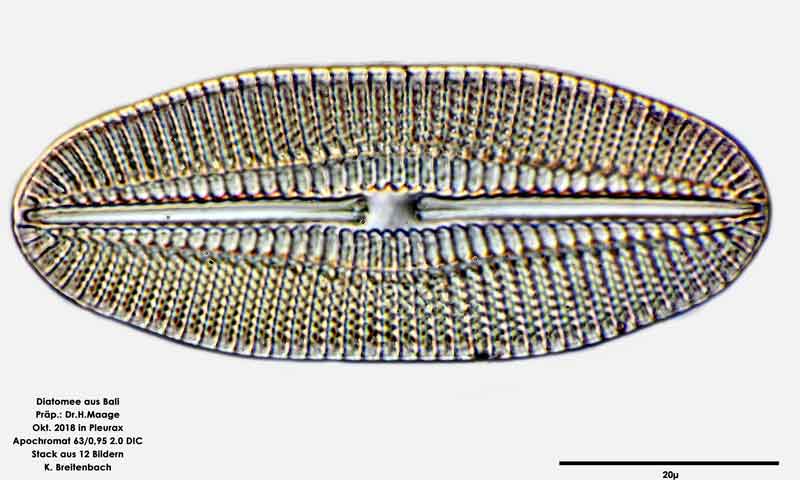 Bild 30 Diatomee aus Bali; Gattung: cf Diploneis sp