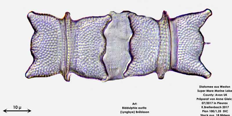 Bild 4 Diatomeen aus Weston Super Mare, UK Art: Biddulphia aurita (Lyngbye) Brébisson