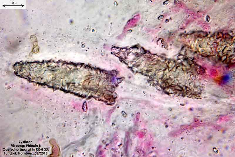 Bild 5 Phlebiopsis gigantea, Zystiden mit Kristallspitzen