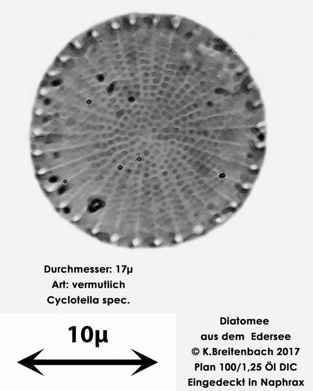 Bild 4 Diatomeen aus dem Edersee, Art: vermutlich Cyclotella spec.