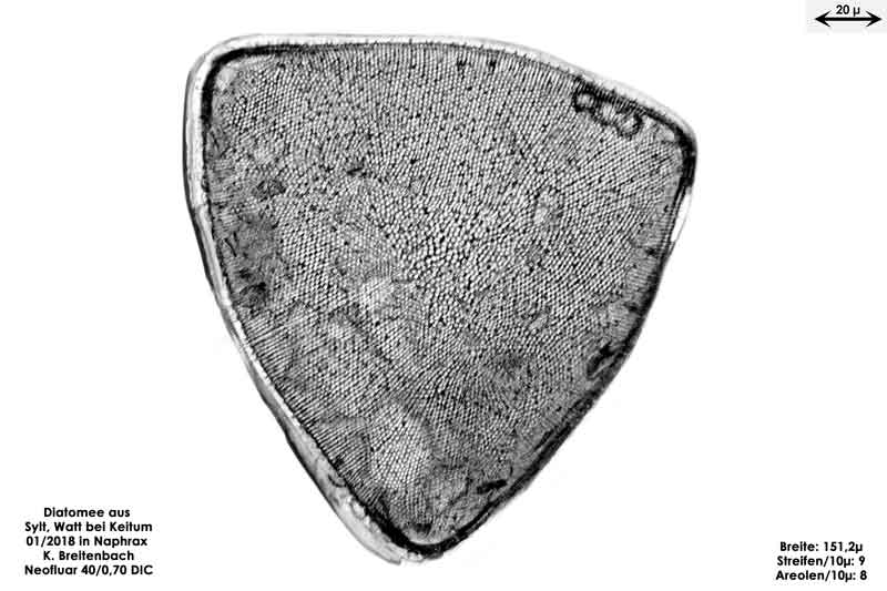 Bild 22 Diatomee aus Sylt/Keitum Watt, Art: Biddulphia rhombus var. trigona Cleve ex Van Heurck 1882