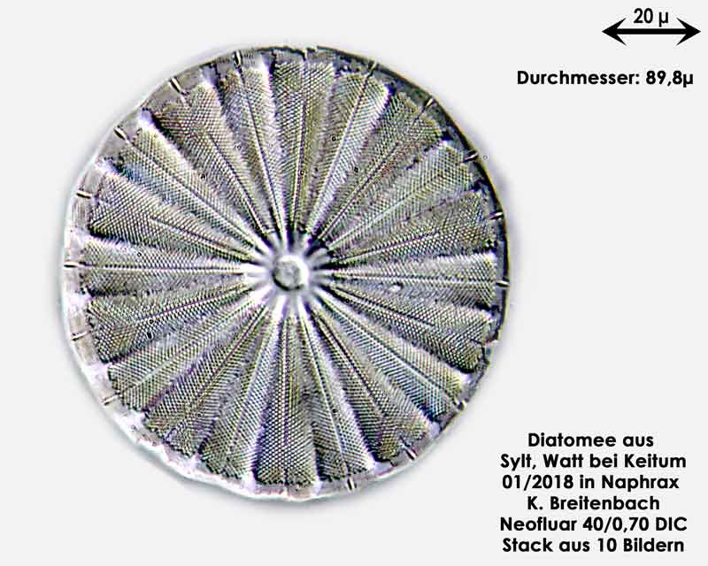 Bild 8 Diatomee aus Sylt/Keitum Watt, Art: Actinoptychus splendens (Shadbolt) Ralfs