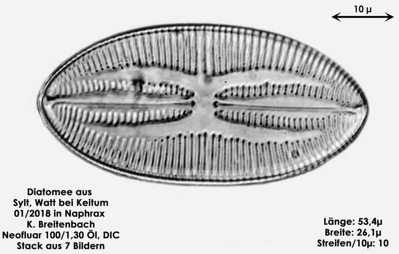 Bild 34 Diatomee aus Sylt/Keitum Watt, Art: Lyrella atlantica (Schmidt), Crawford & Mann 1990