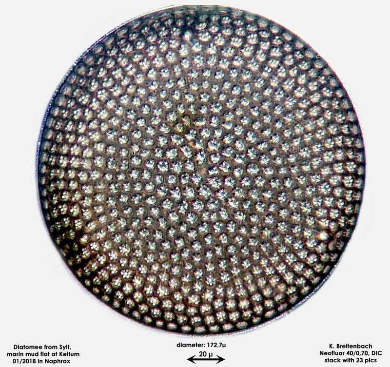 Bild 11 Diatomee aus Sylt/Keitum Watt, Art: Aulacodiscus argus (Ehrenberg) Schmidt 1886