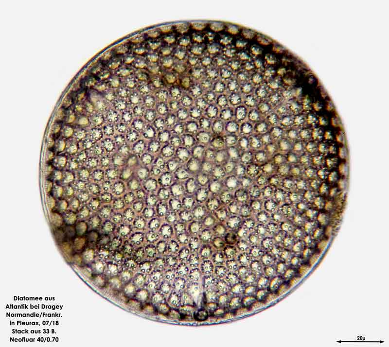 Bild 19 Diatomee aus dem Atlantik bei Draghey de Monton (Normandie). Art: Aulacodiscus argus (Ehrenberg) A.Schmidt