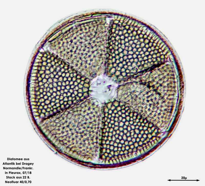 Bild 3 Diatomee aus dem Atlantik bei Draghey de Monton (Normandie). Art: Actinoptychus senarius (Ehrenberg) Ehrenberg 1843