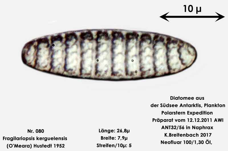 Bild 16 Art: Fragilariopsis kerguelensis (O'Meara) Hustedt 1952