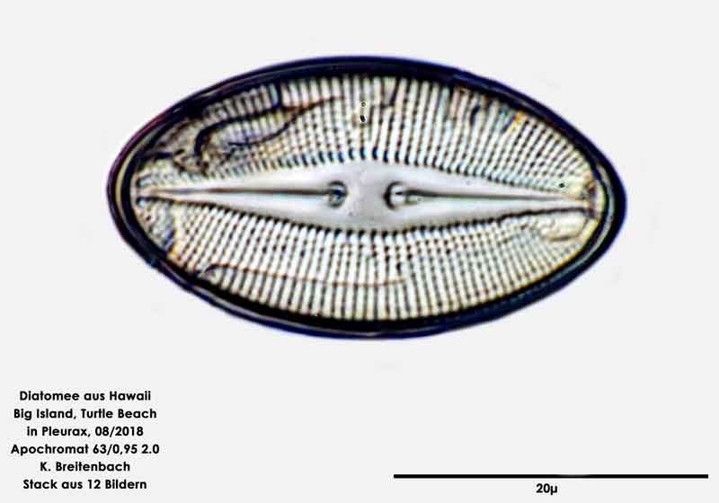 Bild 103 Diatomee aus Hawaii, Big Island, Turtle Beach. Gattung: konnte von mir nicht bestimmt werden